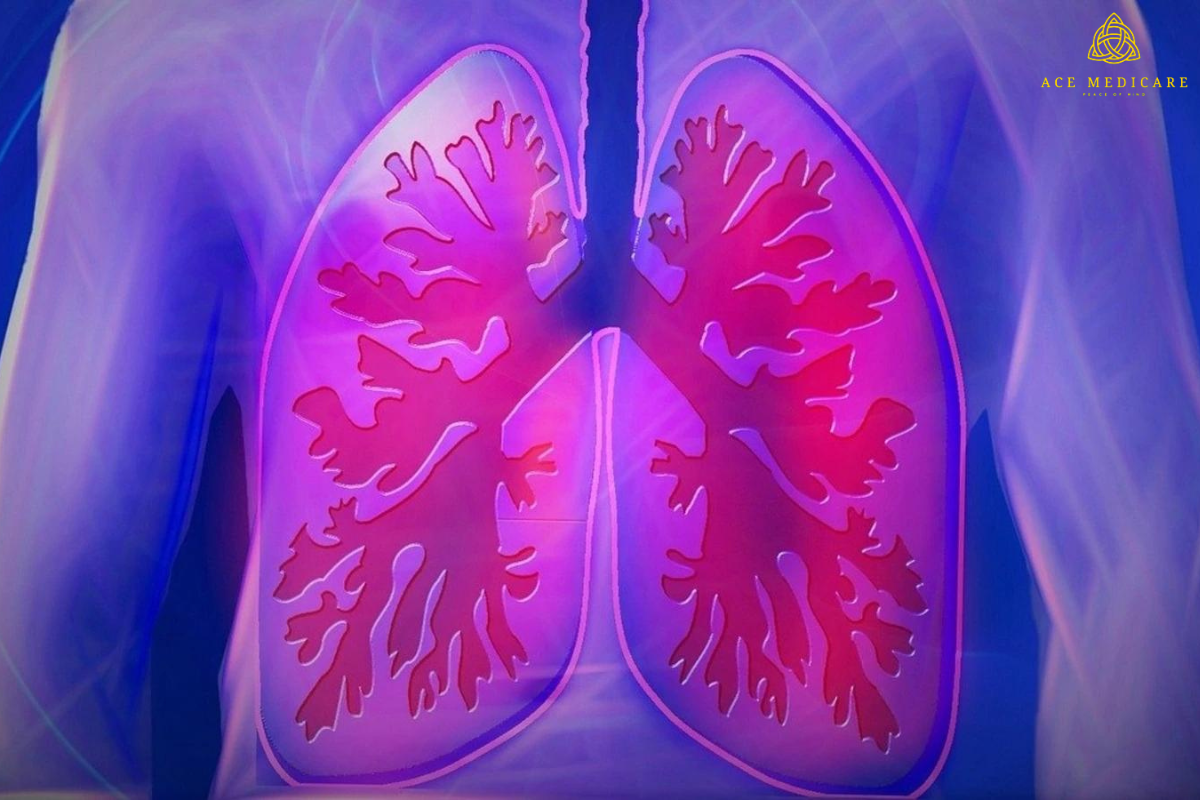 Exploring the Benefits of a Lung Transplant